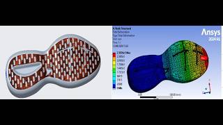 Optimizing Orthotic Dynamic Footwear Sole for Ergonomic Comfort by ANSYS Finite Element Analysis FEA