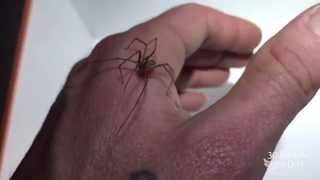Brown Recluse Spider On My Hand