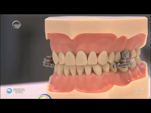 მაგნიტით დაკეტილი ყბა, საკვების მიღებისგან თავის შესაკავებლად - #ექსპერიმენტი