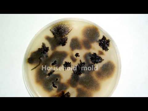 Facts and images of toxic household mold under a microscope