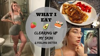 What I Eat & Day In The Life // Feeling Better & Clearing Up My Skin