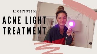 ACNE CLEARING LIGHT || LIGHTSTIM