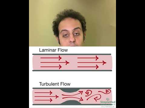 طنين الاذن النابض و عدم انتظام سير الدم في الاوعية الدموية حول الاذن مفتاح العلاج