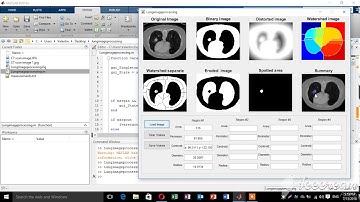 Detecting a Lung Cancer using MATLAB (Image Processing)