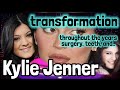 Kylie Jenner surgery transformation throughout the years: lip enhancement implant, teeth now &amp; then