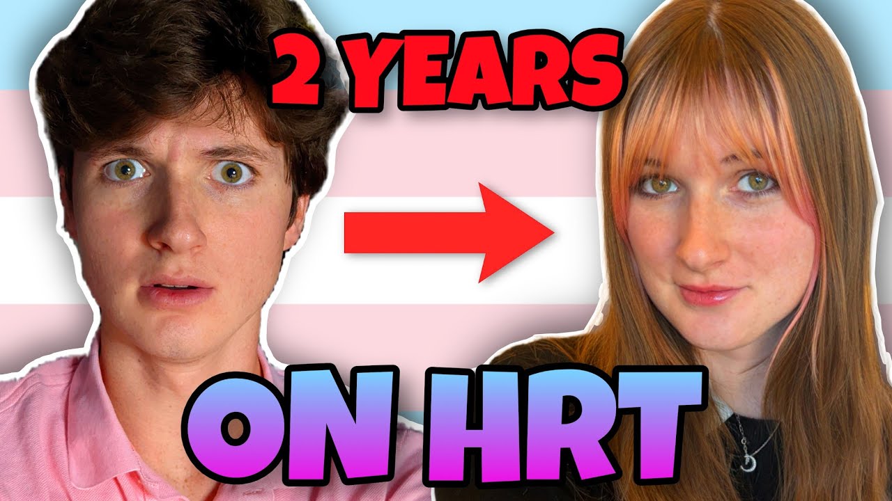 2 года гормональной терапии | Трансгендерная женщина (MTF)
