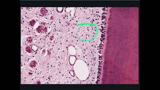 Oral Cavity, Tooth and Gingiva - Decalcified Tooth, Pulp Cavity and Periodontal Ligament