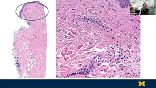 Vascular Diseases and Non-Infectious Granulomatous Dermatoses By Grace Wang MD
