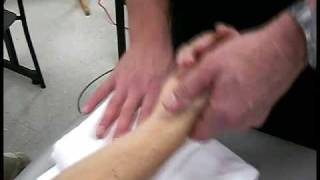 Distal Radioulnar Joint Mobilization