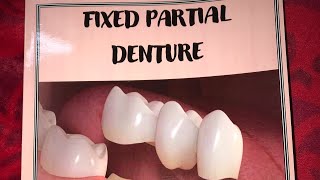 Second book is here! Fixed partial denture 📕✨