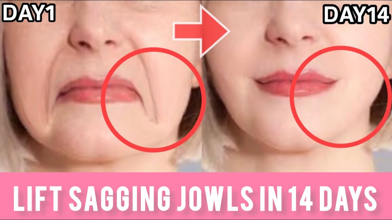 Lift Sagging Jowls and Reduce Laugh Lines / Face Exercise To TIGHTEN