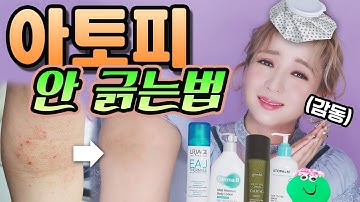 제 아토피가 깨끗해진 비법 싹 다 알랴드림