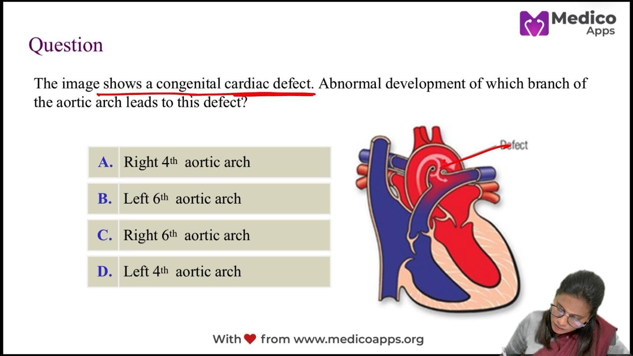 🫀 Открытый артериальный проток (ОАП) | Эмбриология дуги аорты: объяснение | Доктор Суварна Р.