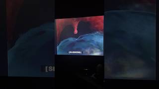 Finding Nemo Whale Uvula