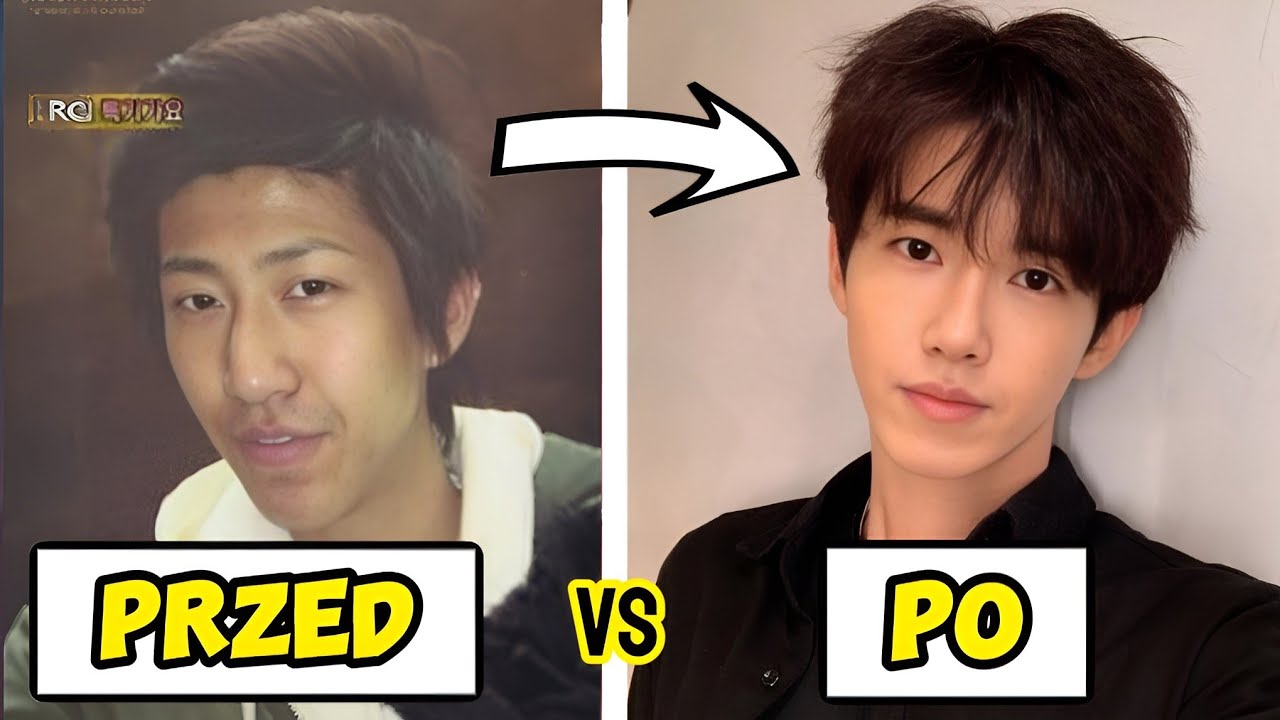 OPERACJE PLASTYCZNE w koreańskim showbiznesie 