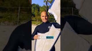 A Surfboard Saved His Life From a Shark Bite! 🏄‍♂️ | Shark Week | Discovery