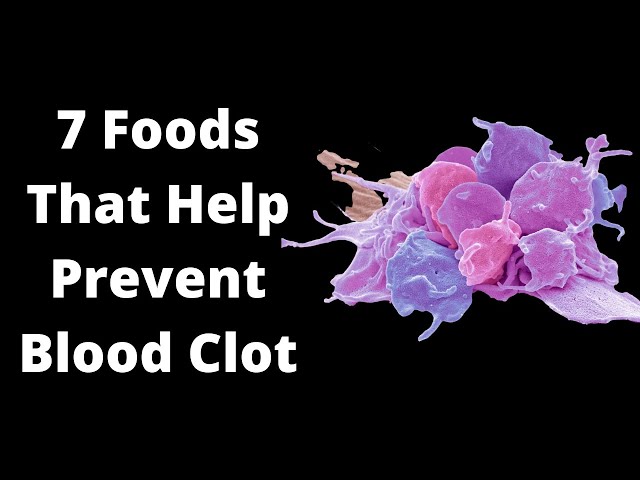 7 Foods That Help Prevent Blood Clot (Blood Thinning Foods) | VisitJoy class=