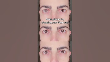Did you know your headaches could be caused by eye misalignment? Prism glasses can help by changing
