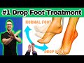 10 BEST Foot Drop Treatments Exercises Braces Shoes Orthotics 10 BEST Foot Drop Treatments Exercises Braces Shoes Orthotics