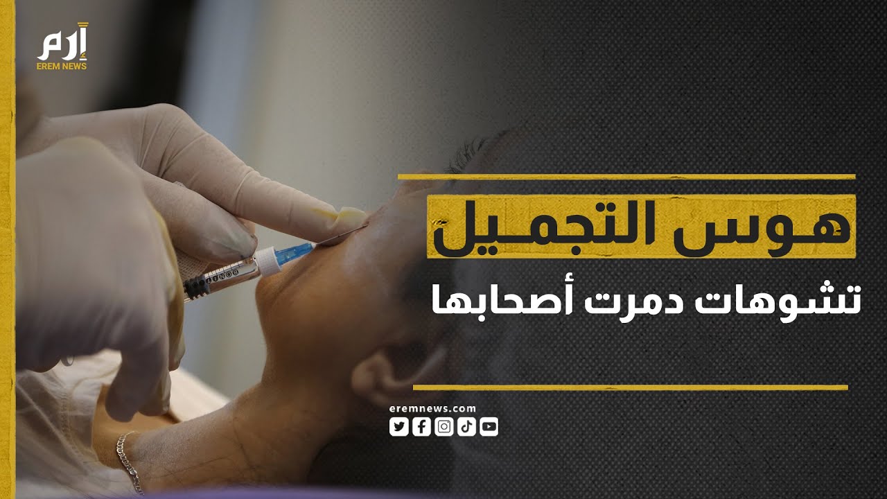 هوس التجميل.. فيروس يزداد انتشارا وتشوهات دمرت أصحابها