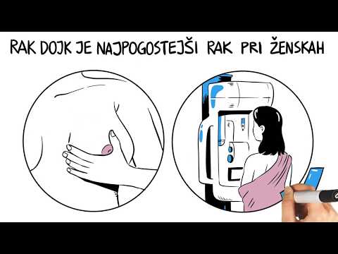 Video: Rak Dojk Pri Mladih ženskah: Kako Se Razlikuje?