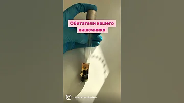 Клостридии - анаэробные бактерии, обитающие в нашем кишечнике. Колонии на среде Вильсона -Блэра.