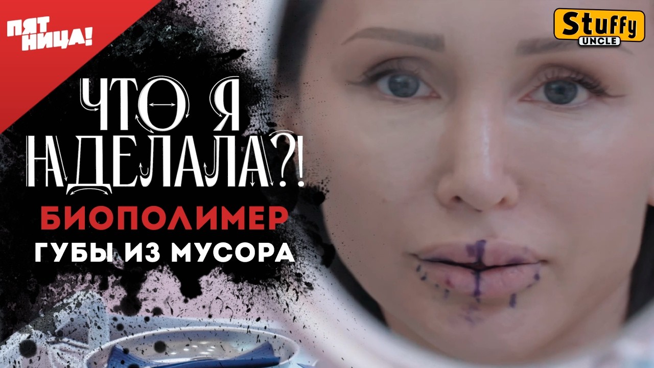 Что я наделала? - Биополимер. Губы из мусора