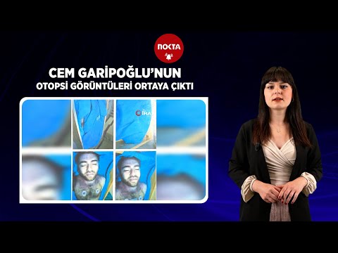Cem Garipoğlu’nun otopsi fotoğrafı servis edildi? Fotoğrafın gerçekliği tartışılıyor!