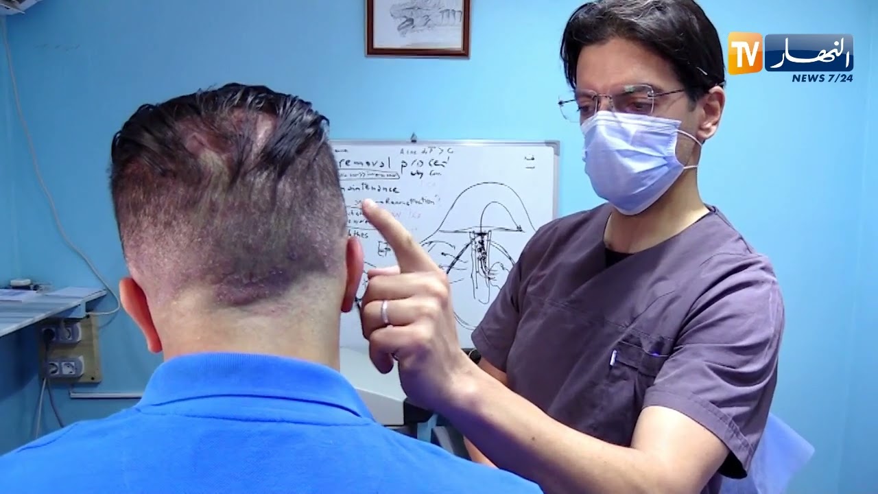 معاناة مرضى الصدفية..غياب العلاج وصعوبة التشخيص