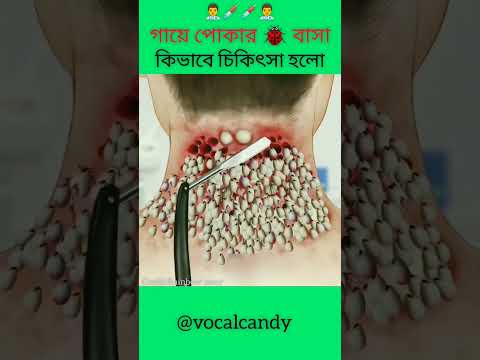 ভিডিও: ধুলো কামড়েছে?