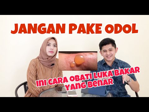 Video: Cara Menusuk dan Menguras Lepuh: 14 Langkah (dengan Gambar)