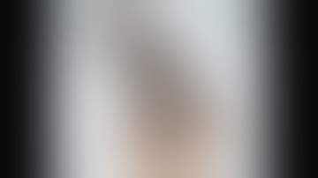 Cotton Osteotomy with the Arthrex Biosync Anatomic Porous Coated Titanium Wedge