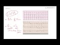 LVH on ECG (Left ventricular hypertrophy) - Learn ECG! - Dr Jamal USMLE