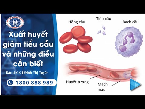 Hồng Cầu Giảm Là Bệnh Gì - Xuất huyết giảm tiểu cầu - Bác sĩ Chuyên khoa I Đinh Thị Tuyến - Trung tâm Huyết học - Truyền máu