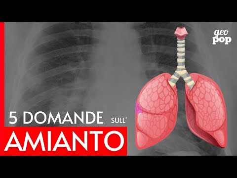 Video: Quando PCos è pericoloso?