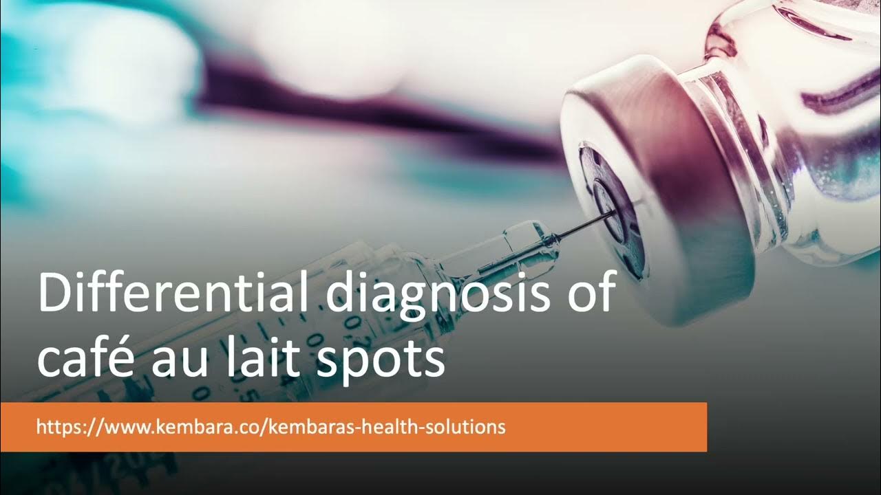 Differential Diagnosis Of Caf Au Lait Spots YouTube differential-diagnosis-of-caf-au-lait-spots-youtube