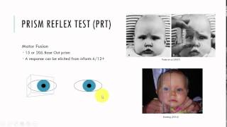 Prism Reflex Test