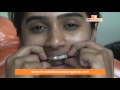 Clear Path Invisble Braces Patient Review in Bangalore | Clear Aligner Braces in Karnataka, India