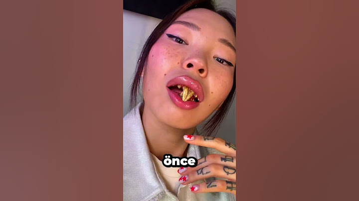 Bu Kadının Dişleri Niçin Böyle? 🦷❓