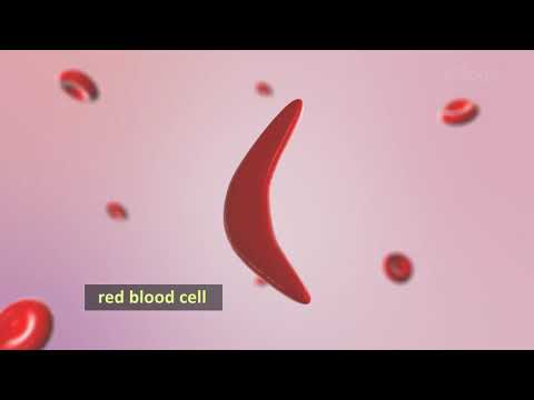 GENETIC DISEASES/Sickle cell Anemia/Hemophilia/Cancer
