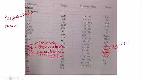 Đọc công thức máu chẩn đoán thiếu máu Anemia 2
