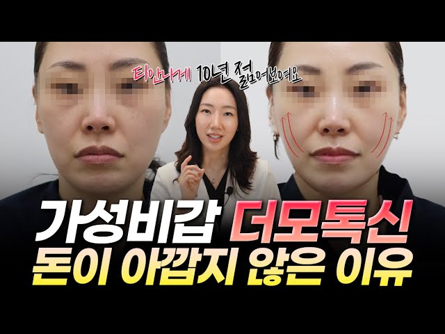 놓치지 않고 꼭 맞아야 할 더모톡신 추천부위와 함께 하면 좋은 피부시술