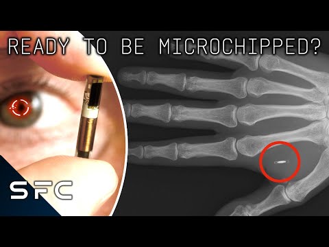 ID Tags In Human Beings! | RFID Chips | The Conspiracy Show | S3E05