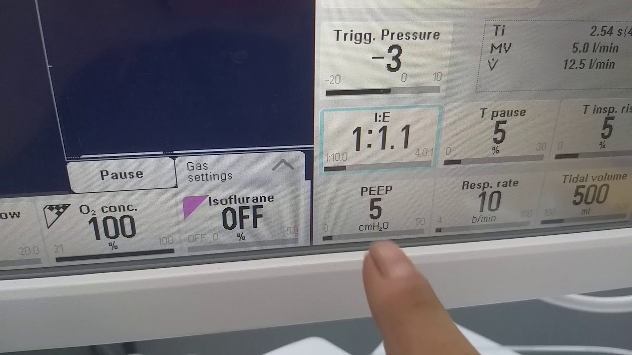 نسبة ال I:E في جهاز التخدير