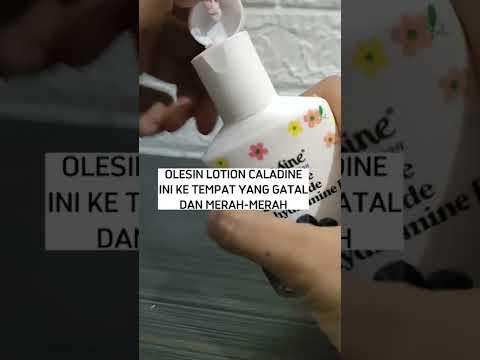 Video: Bagaimana cara menggunakan losyen calamine?