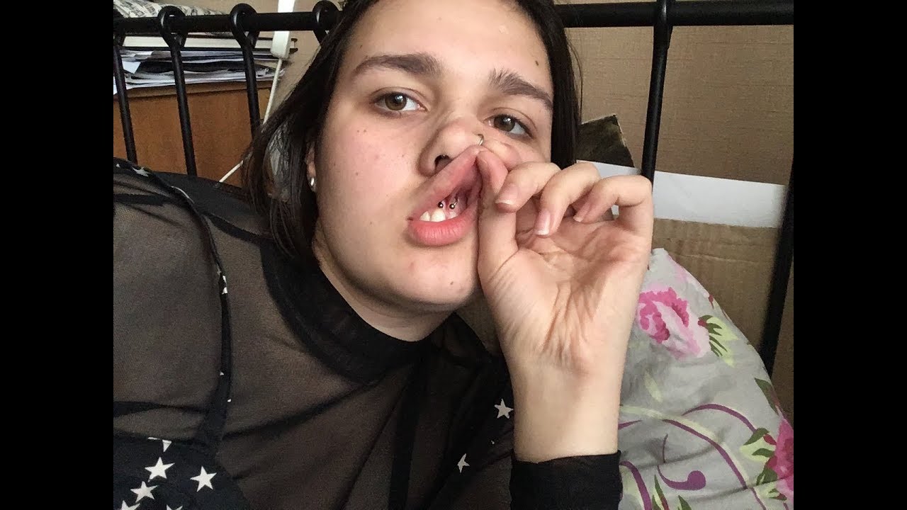 Смайл Пирсинг. Прокол уздечки под губой. - YouTube