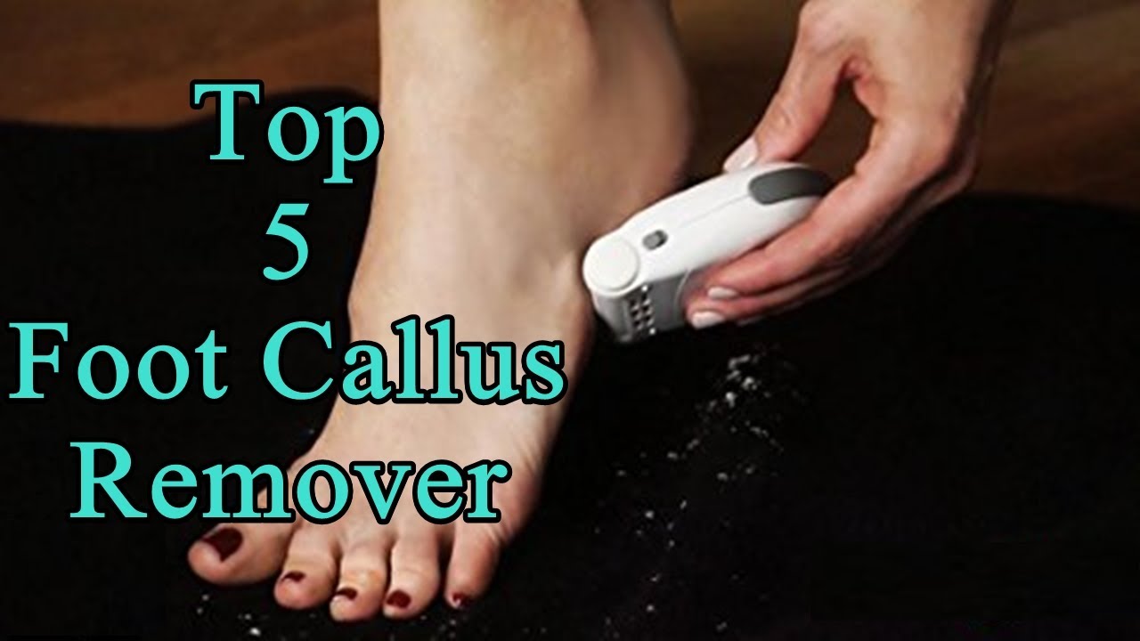 Top 5 Best Foot Callus Remover 2018