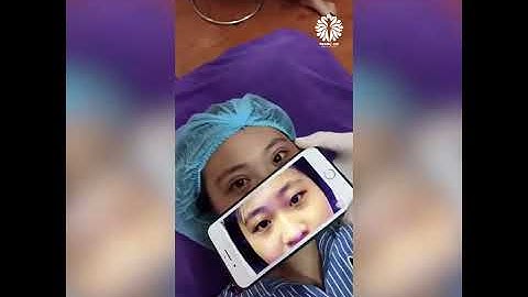 Video cắt mí mini-deep số 11