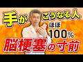 【脳梗塞の前兆】見逃し厳禁!手に現れる脳梗塞の直前の危険サインを解説