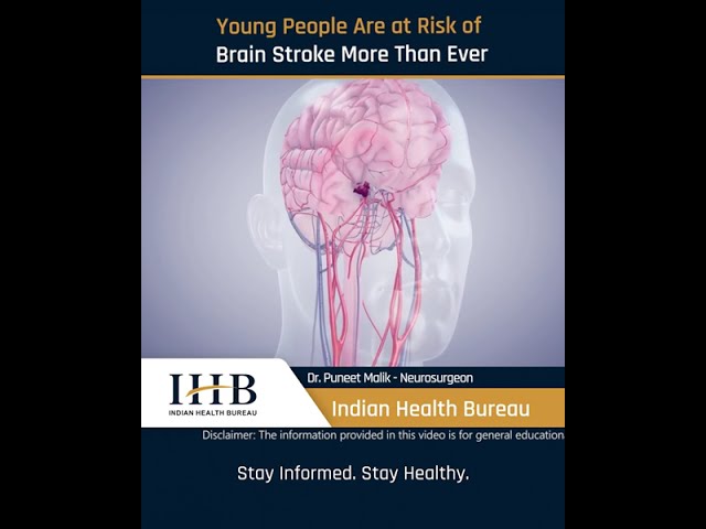 Young People Are at Risk of Brain Stroke More Than Ever